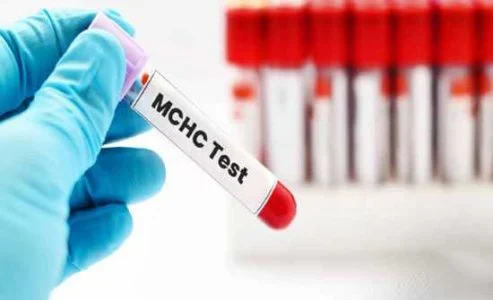  علائم MCHC بالا در آزمایش خون چیست؟‌