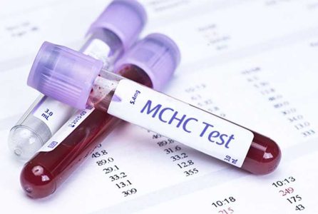  علائم MCHC بالا در آزمایش خون چیست؟‌