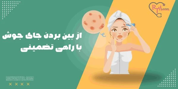 از بین بردن جای جوش با راهی تضمینی