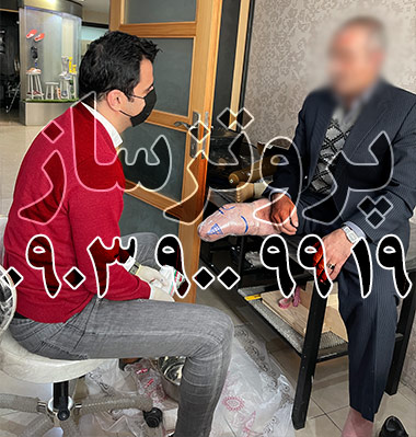 راهنمای انتخاب انواع مفاصل در پروتز پا