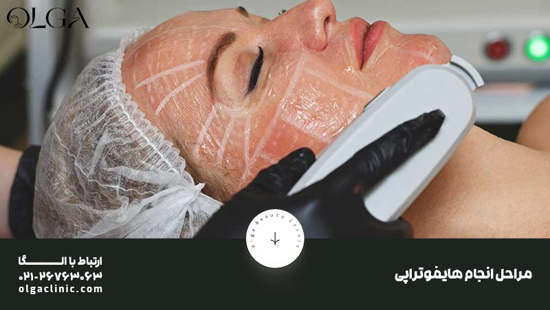 هایفوتراپی؛ تکنیکی جدید برای جوانسازی و لیفت طبیعی پوست